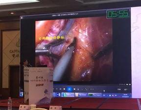 国产太阳能镜子视频